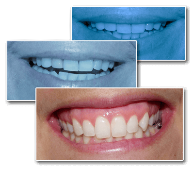 Collage of Teeth Images